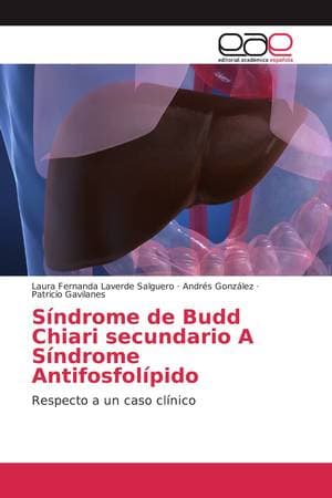 Budd Chiari Secundario a Síndrome Antifosfolípido